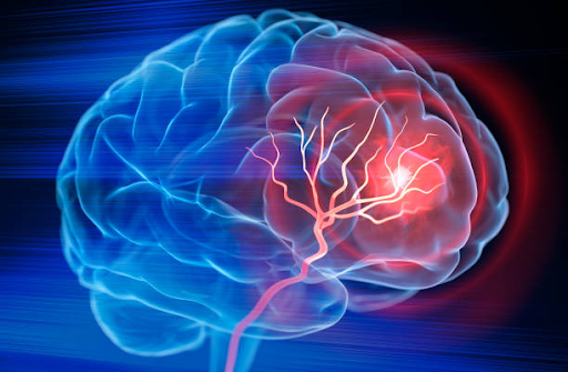 Sleep Apnea risks image of brain  for can people die from sleep apnea blog